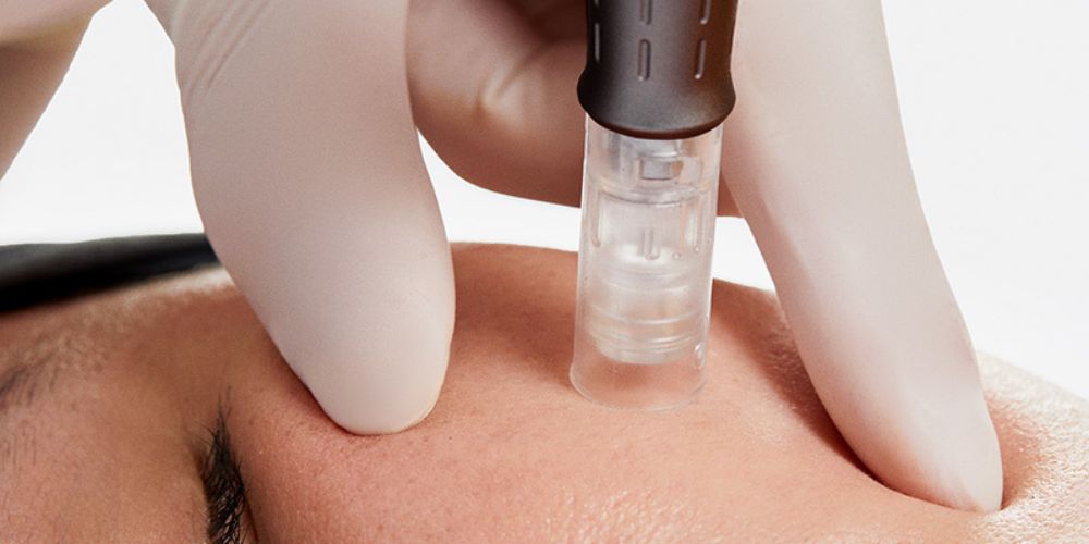 nanoinfuze